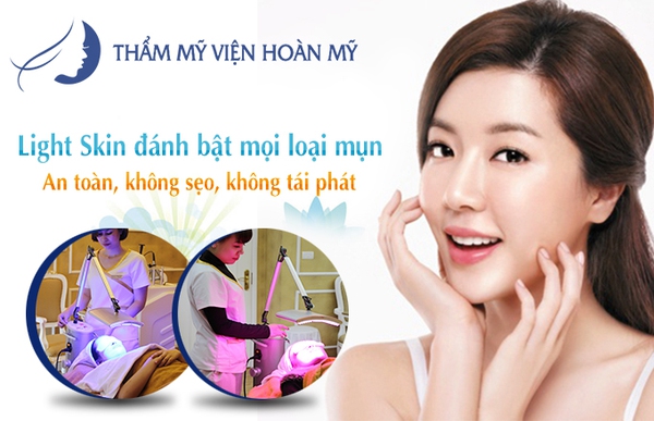B&iacute; k&iacute;p "thổi bay" mụn đ&oacute;n nắng h&egrave; 4