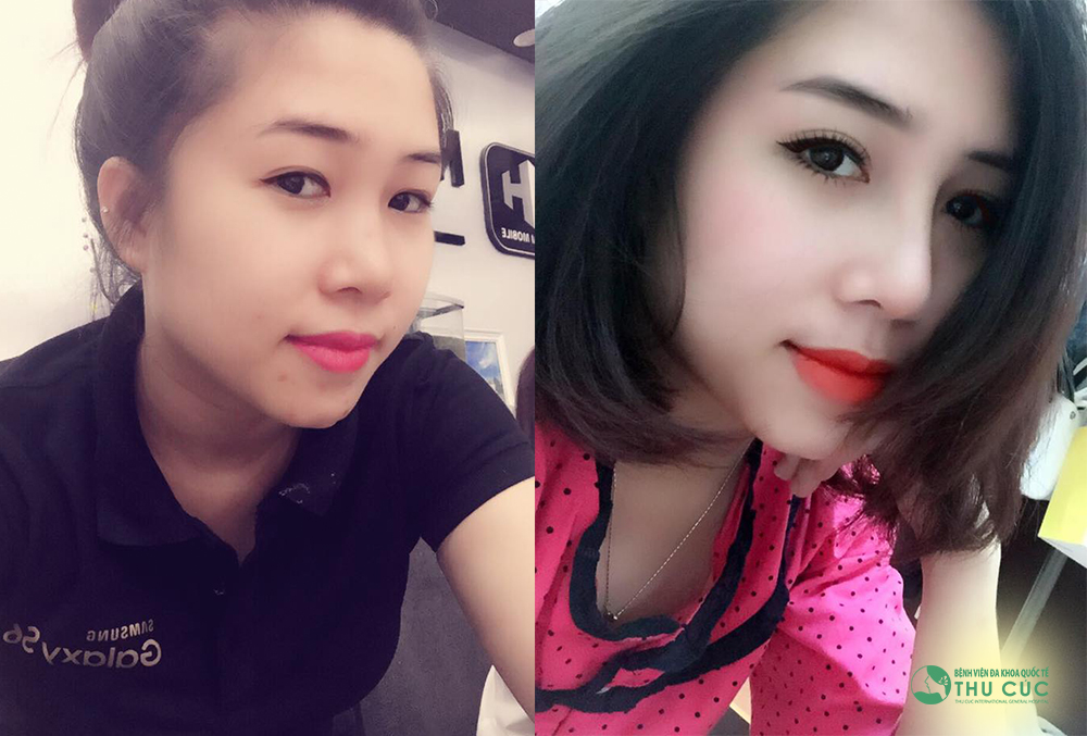 Nhan sắc cô chủ 9X “lột xác” nhờ nâng mũi chuẩn Sline - Ảnh 2.