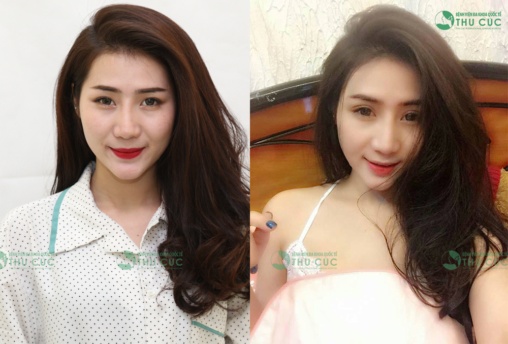 Sự thay đổi kỳ diệu của nền thẩm mỹ hiện đại - Ảnh 2.