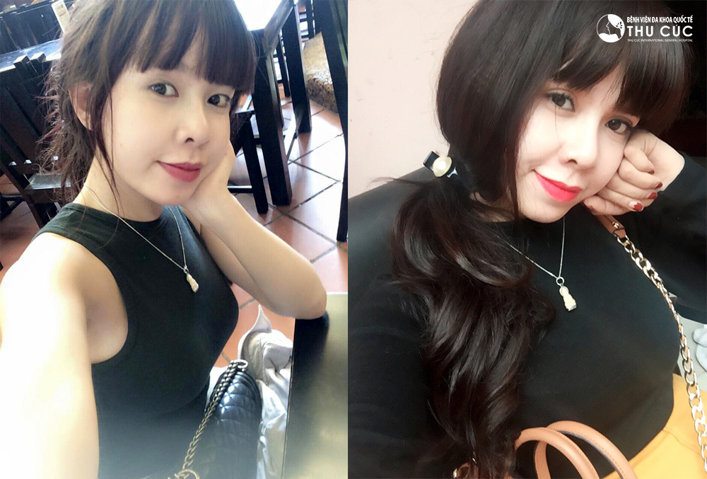 Sự thay đổi kỳ diệu của nền thẩm mỹ hiện đại - Ảnh 3.