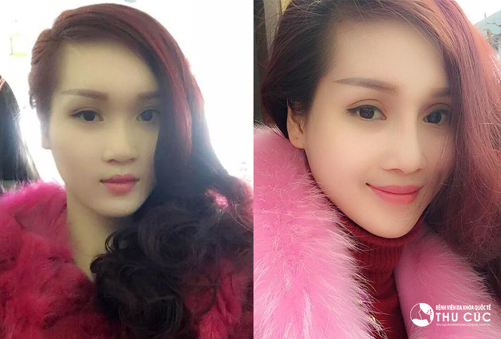 Sự thay đổi kỳ diệu của nền thẩm mỹ hiện đại - Ảnh 4.