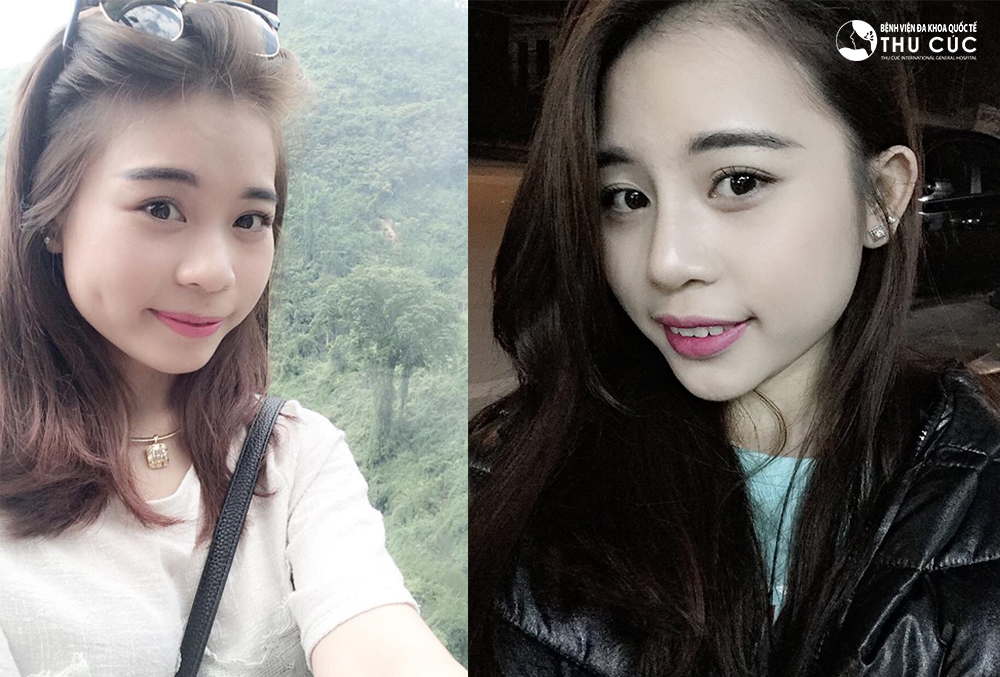 Sự thay đổi kỳ diệu của nền thẩm mỹ hiện đại - Ảnh 6.