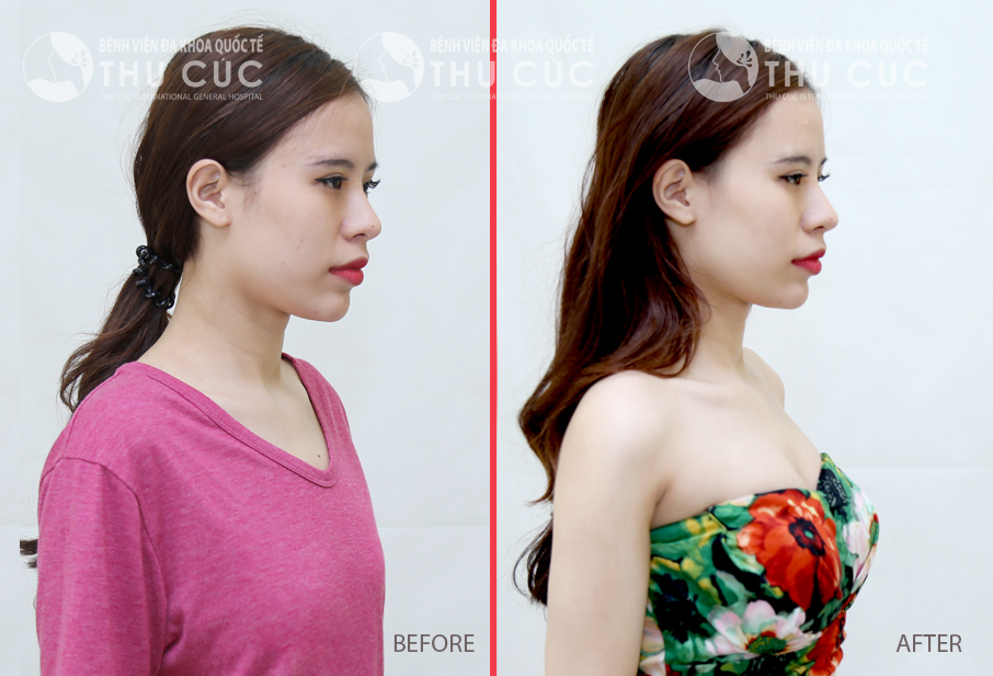 Sự thay đổi kỳ diệu của nền thẩm mỹ hiện đại - Ảnh 7.