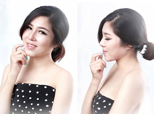 Giới trẻ Việt tiết lộ lý do thực hiện phẫu thuật nâng mũi - Ảnh 3.