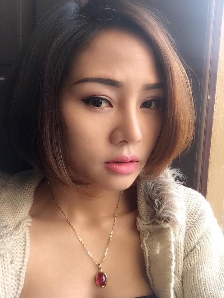 C&ocirc; n&agrave;ng 9X tươi tắn hơn bội phần nhờ phẫu thuật cắt m&iacute; mắt - Ảnh 4.