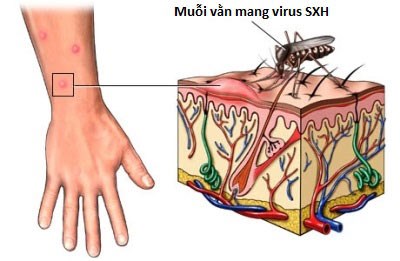 Những bệnh nguy hiểm bất kì ai cũng có thể gặp khi thời tiết chuyển lạnh - Ảnh 2.