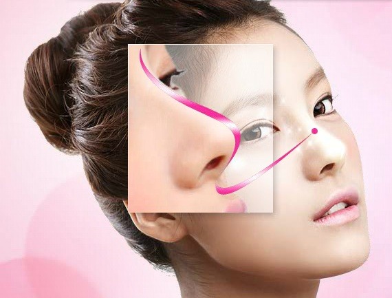 Tuyệt chiêu tạo mũi S-line cho người sợ đau - Ảnh 1.