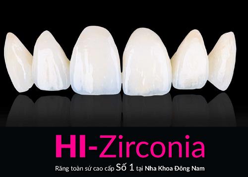HI–Zirconia – Giải pháp làm răng sứ cao cấp - Ảnh 2.