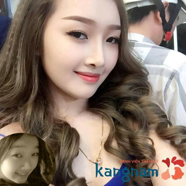 Cận cảnh quy tr&igrave;nh biến h&oacute;a sắc đẹp Korean Beauty Triangle ở Kangnam - Ảnh 4.