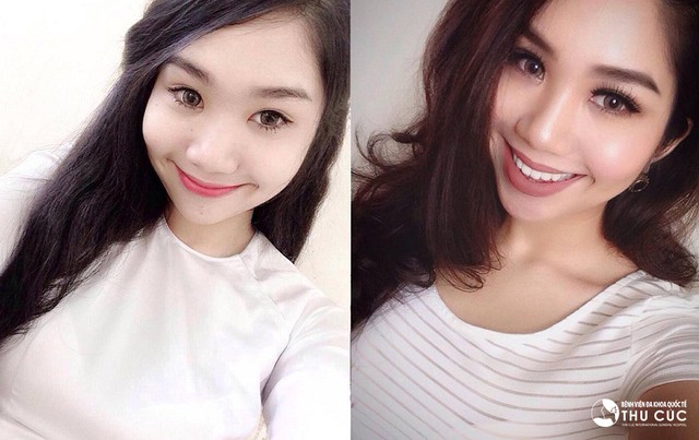 C&ocirc; n&agrave;ng 9X được v&iacute; l&agrave; bản sao Phạm Hương sau thẩm mỹ - Ảnh 6.