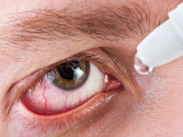 Chuyên gia tư vấn cách chọn kính áp tròng và chuyện cung cấp oxy cho mắt - Ảnh 4.