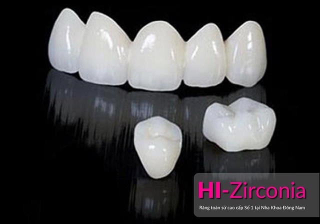 HI–Zirconia – Giải pháp làm răng sứ cao cấp - Ảnh 1.