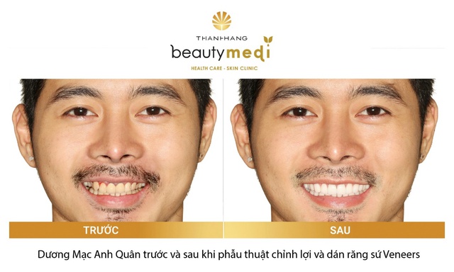 B&iacute; quyết nụ cười tỏa nắng của ch&agrave;ng so&aacute;i ca &ldquo;Hậu duệ mặt trời&rdquo; phi&ecirc;n bản Việt - Ảnh 2.