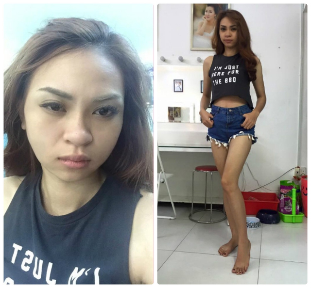 B&agrave; mẹ đơn th&acirc;n, c&ocirc; g&aacute;i trầm cảm v&agrave; nữ ca sĩ thừa c&acirc;n gi&agrave;nh giải nhất thẩm mỹ miễn ph&iacute; - Ảnh 2.