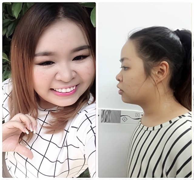 B&agrave; mẹ đơn th&acirc;n, c&ocirc; g&aacute;i trầm cảm v&agrave; nữ ca sĩ thừa c&acirc;n gi&agrave;nh giải nhất thẩm mỹ miễn ph&iacute; - Ảnh 4.